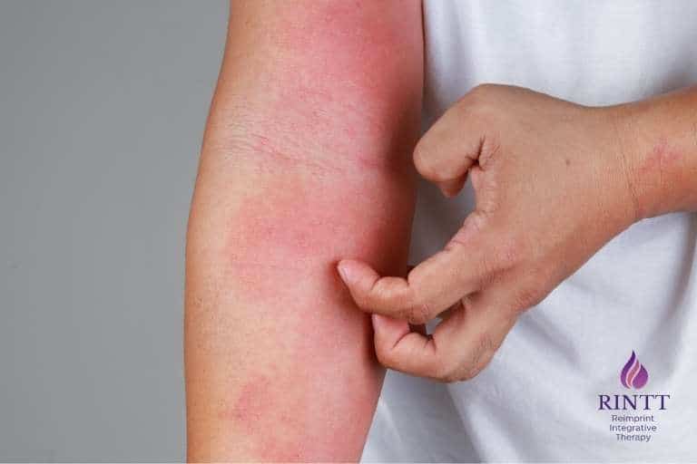 Itchy skin 768x512